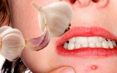 garlic beauty
